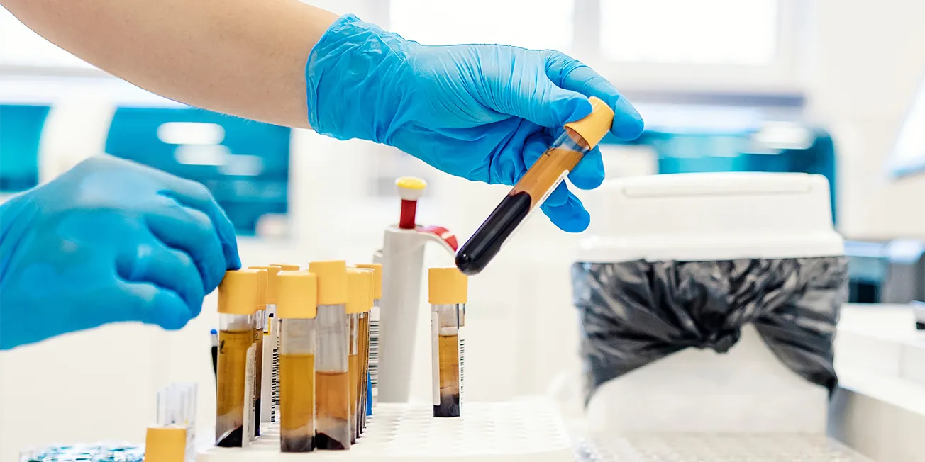 Blodet sentrifugeres.